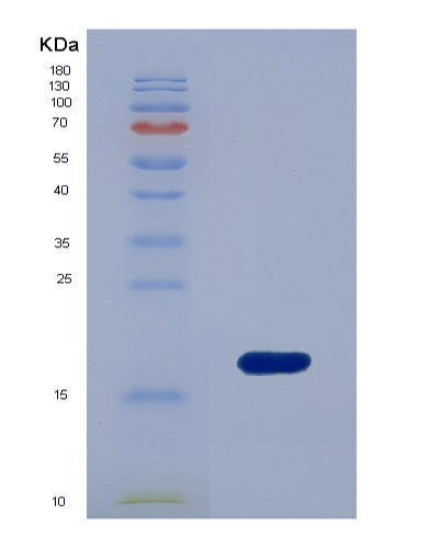 Human GCA (Grancalcin) - Recombinant Protein