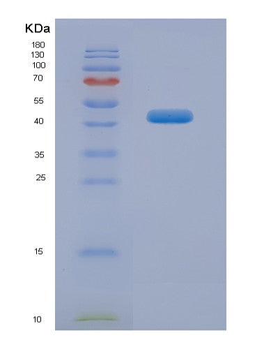 Human SERPINB3 (Serpin B3) - Recombinant Protein