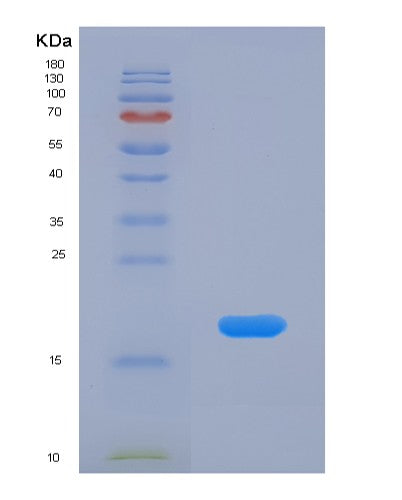 Human CRABP1 (Cellular Retinoic Acid-Binding Protein 1) - Recombinant Protein