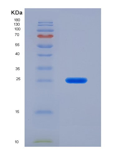 Human BLVRB (Flavin Reductase (Nadph)) - Recombinant Protein