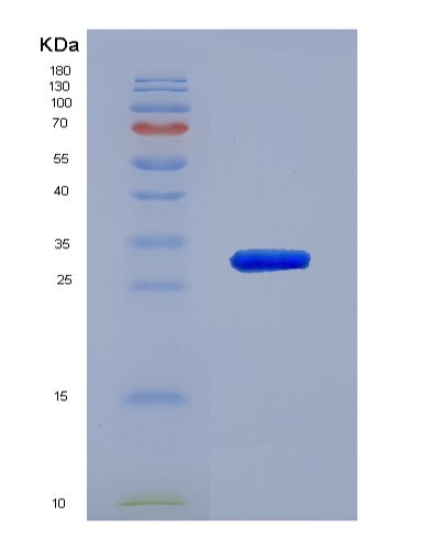 Human PDIA3 (Protein Disulfide-Isomerase A3) - Recombinant Protein
