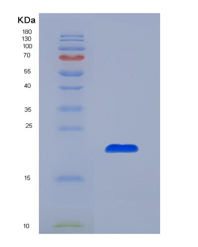 Human CDC25A (M-Phase Inducer Phosphatase 1) - Recombinant Protein