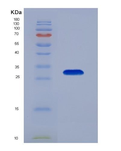 Human LRPAP1 (Alpha-2-Macroglobulin Receptor-Associated Protein) - Recombinant Protein