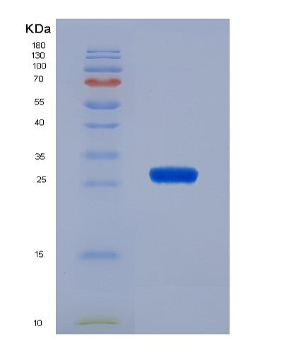 Human PKLR (Pyruvate Kinase Pklr) - Recombinant Protein