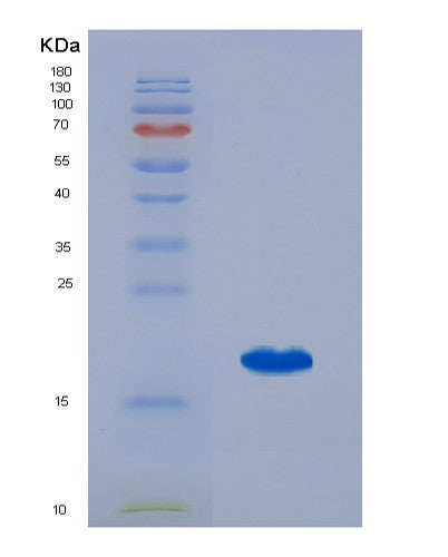 Human SRI (Sorcin) - Recombinant Protein