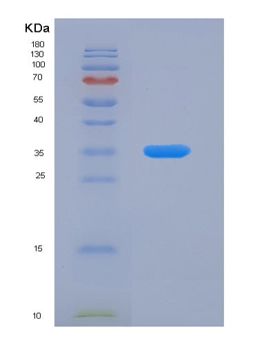 Human GDI1 (Rab Gdp Dissociation Inhibitor Alpha) - Recombinant Protein