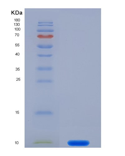 Human S100A7 (Protein S100-A7) - Recombinant Protein