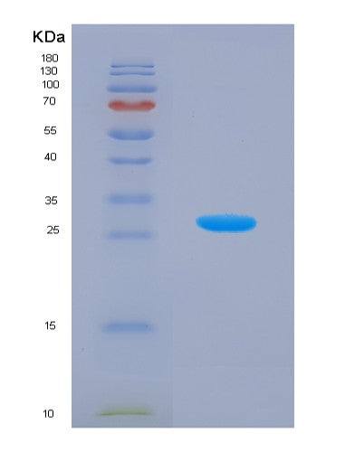 Human MAT2A (S-Adenosylmethionine Synthase Isoform Type-2) - Recombinant Protein