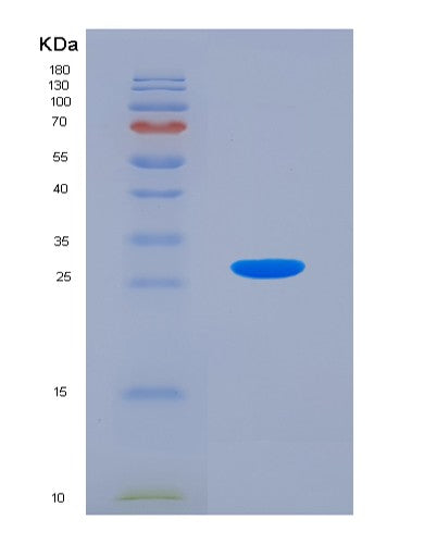 Human CASQ1 (Calsequestrin-1) - Recombinant Protein