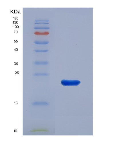 Human STIP1 (Stress-Induced-Phosphoprotein 1) - Recombinant Protein