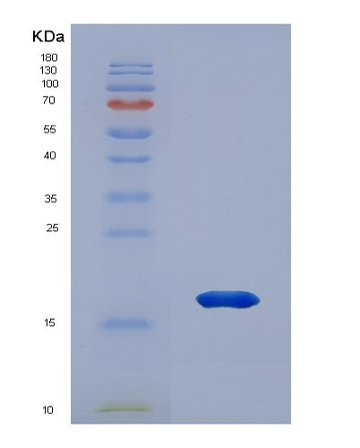 Human PRDX2 (Peroxiredoxin-2) - Recombinant Protein