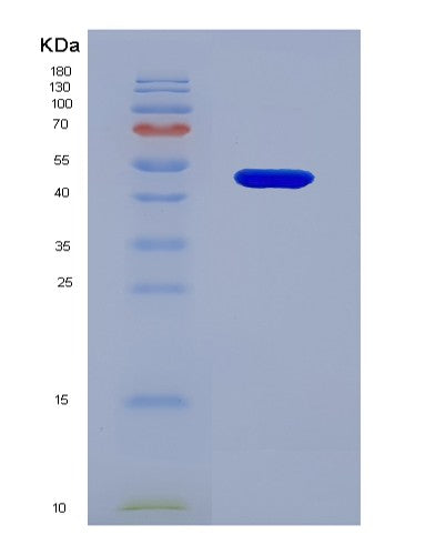 Human TNNC1 (Troponin C, Slow Skeletal And Cardiac Muscles) - Recombinant Protein