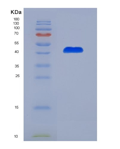 Human CD70 (Cd70 Antigen) - Recombinant Protein