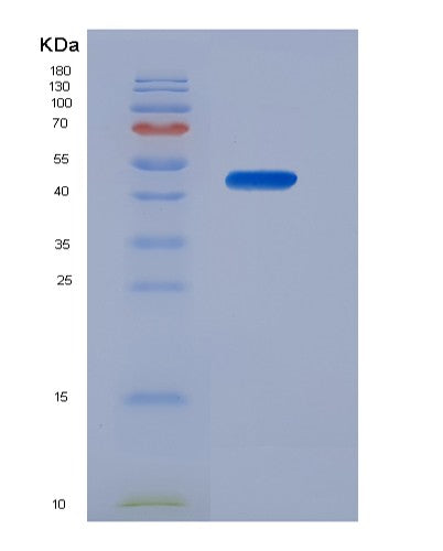 Human MPI (Mannose-6-Phosphate Isomerase) - Recombinant Protein
