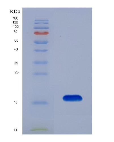 Human BTC (Probetacellulin) - Recombinant Protein