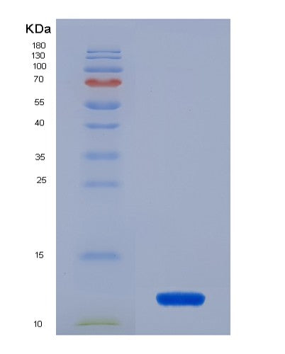 Human PHB1 (Prohibitin 1) - Recombinant Protein