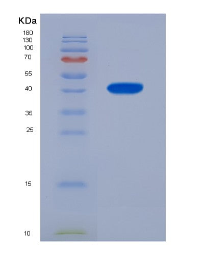 Human SERPINB6 (Serpin B6) - Recombinant Protein