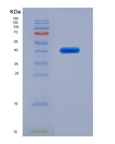 Human SFTPD (Pulmonary Surfactant-Associated Protein D) - Recombinant Protein