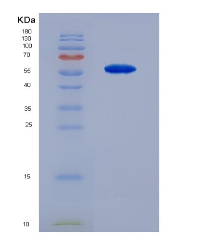 Human SPR (Sepiapterin Reductase) - Recombinant Protein