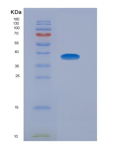 Human HMGCL (Hydroxymethylglutaryl-Coa Lyase, Mitochondrial) - Recombinant Protein
