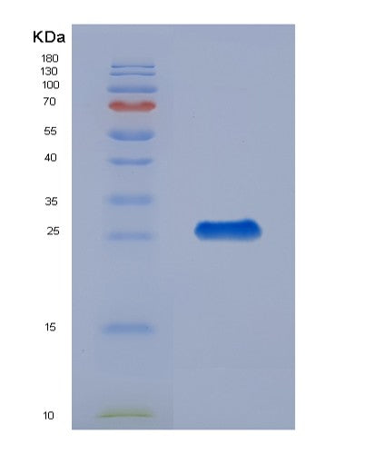 Human CHI3L1 (Chitinase-3-Like Protein 1) - Recombinant Protein