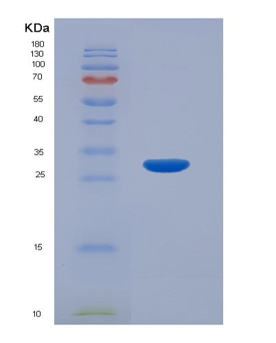 Human MAP2K2 (Dual Specificity Mitogen-Activated Protein Kinase Kinase 2) - Recombinant Protein