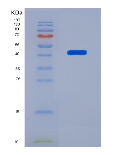 Human SERPINB5 (Serpin B5) - Recombinant Protein