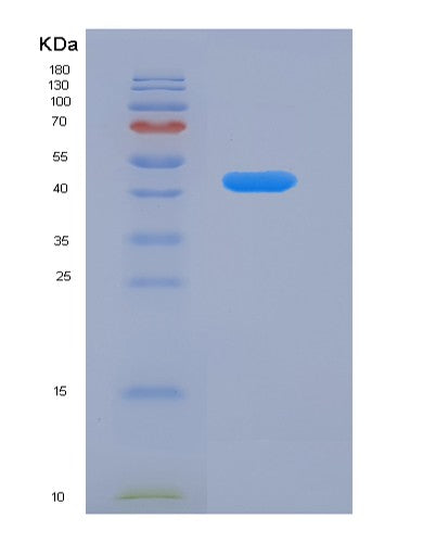 Human SERPINF1 (Pigment Epithelium-Derived Factor) - Recombinant Protein