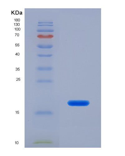 Human FDFT1 (Squalene Synthase) - Recombinant Protein