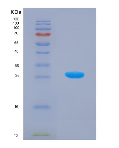 Human TAGLN2 (Transgelin-2) - Recombinant Protein