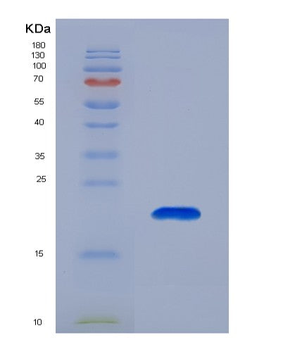 Human RPS19 (Small Ribosomal Subunit Protein Es19) - Recombinant Protein