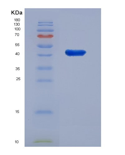 Human DDOST (Dolichyl-Diphosphooligosaccharide--Protein Glycosyltransferase 48 Kda Subunit) - Recombinant Protein