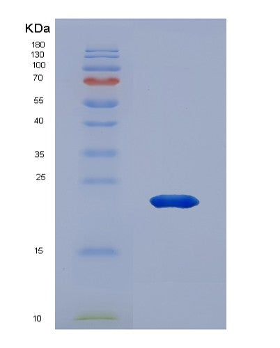 Human ANP32A (Acidic Leucine-Rich Nuclear Phosphoprotein 32 Family Member A) - Recombinant Protein