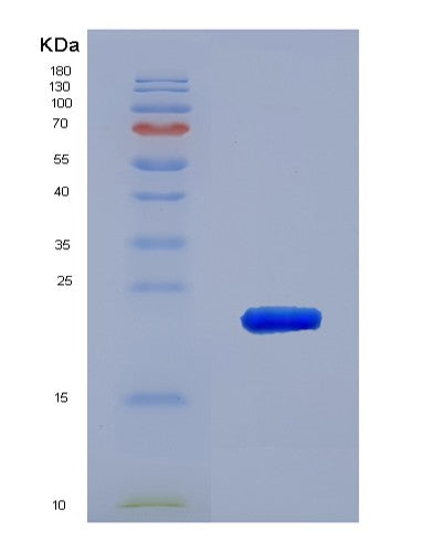 Human MMP12 (Macrophage Metalloelastase) - Recombinant Protein