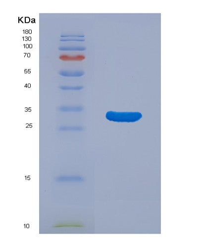 Human TXLNA (Alpha-Taxilin) - Recombinant Protein