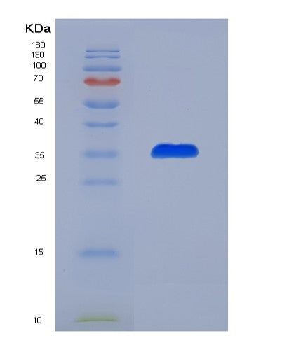 Human PEX19 (Peroxisomal Biogenesis Factor 19) - Recombinant Protein