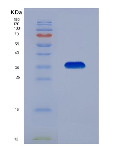 Human MDH2 (Malate Dehydrogenase, Mitochondrial) - Recombinant Protein