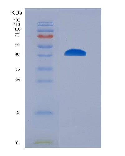 Human BCL6 (B-Cell Lymphoma 6 Protein) - Recombinant Protein