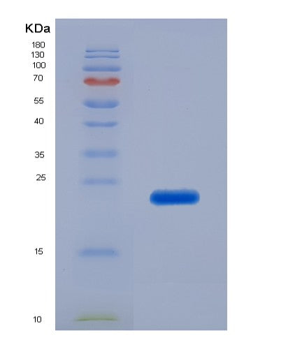Human GARS1 (Glycine--Trna Ligase) - Recombinant Protein
