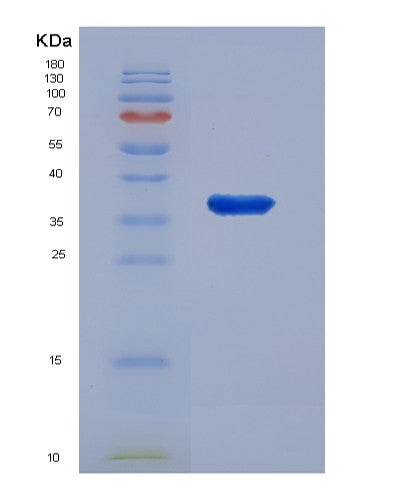 Human CXCL5 (C-X-C Motif Chemokine 5) - Recombinant Protein