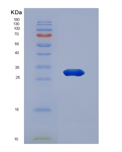 Mouse Gpt (Alanine Aminotransferase 1) - Recombinant Protein