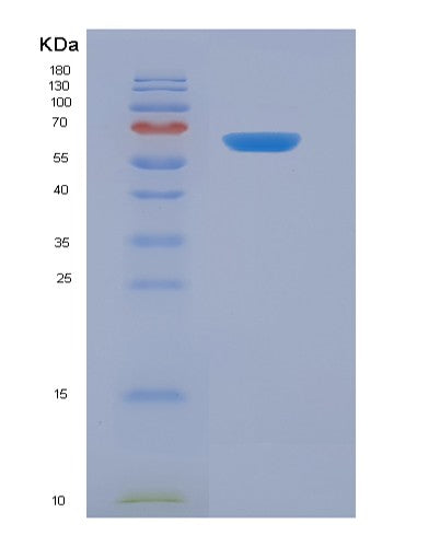 Human KIR3DL1 (Killer Cell Immunoglobulin-Like Receptor 3Dl1) - Recombinant Protein