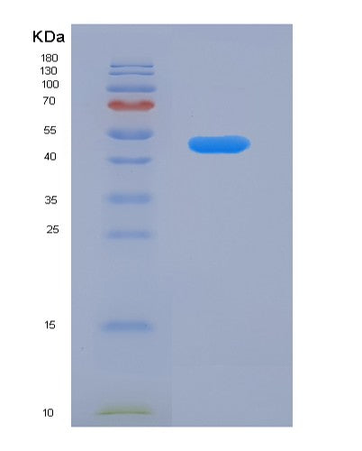 Human ACADSB (Short/Branched Chain Specific Acyl-Coa Dehydrogenase, Mitochondrial) - Recombinant Protein