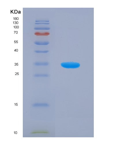 Human MAPK9 (Mitogen-Activated Protein Kinase 9) - Recombinant Protein