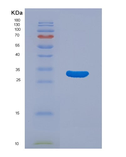 Human MAP2K3 (Dual Specificity Mitogen-Activated Protein Kinase Kinase 3) - Recombinant Protein