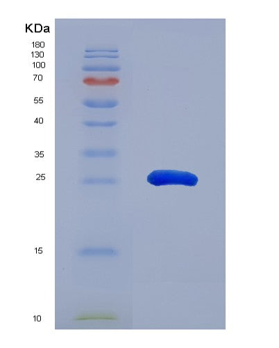 Human SOX2 (Transcription Factor Sox-2) - Recombinant Protein