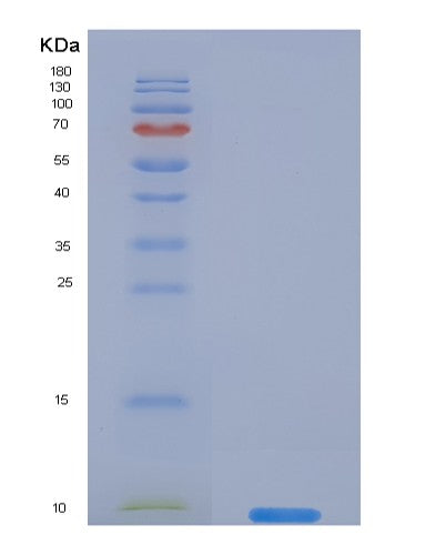 Human SERPINB4 (Serpin B4) - Recombinant Protein