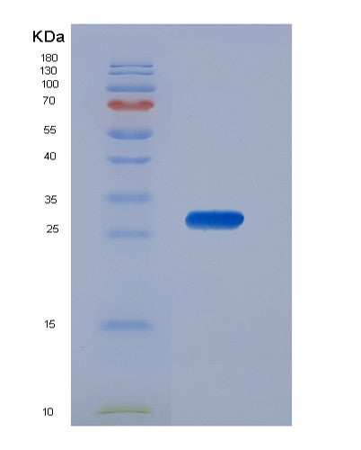 Human CSNK1A1 (Casein Kinase I Isoform Alpha) - Recombinant Protein