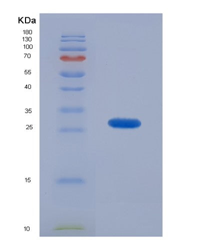 Human CAMLG (Guided Entry Of Tail-Anchored Proteins Factor Camlg) - Recombinant Protein