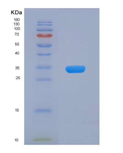Human CDC34 (Ubiquitin-Conjugating Enzyme E2 R1) - Recombinant Protein